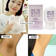 snow white spot gel