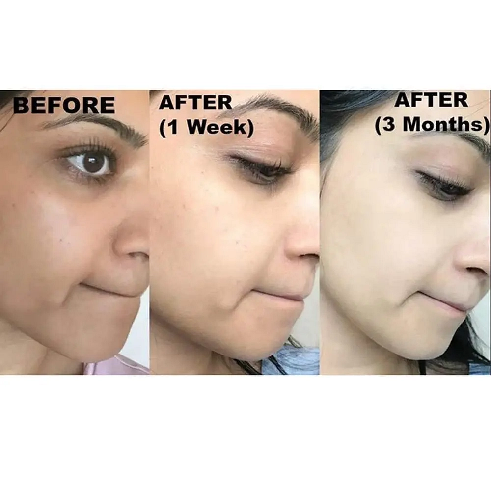 Kojie San Skin Lightening Kojic Acid Soap